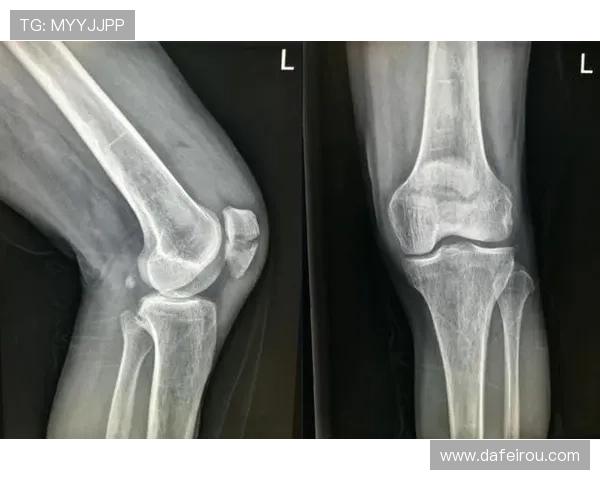 法比安左膝髌骨裂未愈暂不出战 法比安左膝髌骨裂未愈暂不出战